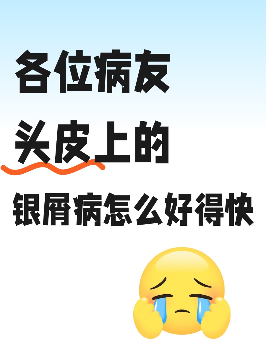 头上银屑病怎么好得快？医生来支招💐