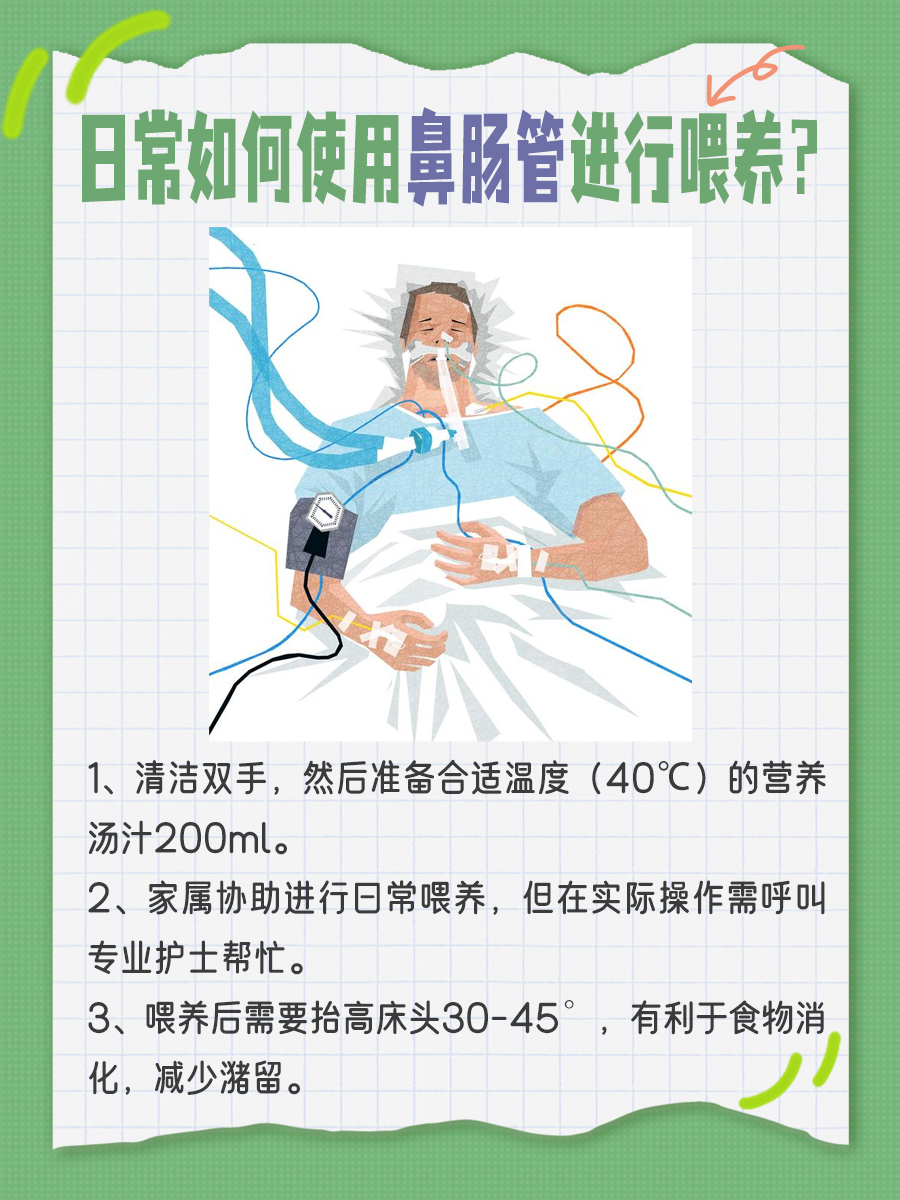 鼻肠管日常护理要点：注意事项须知！