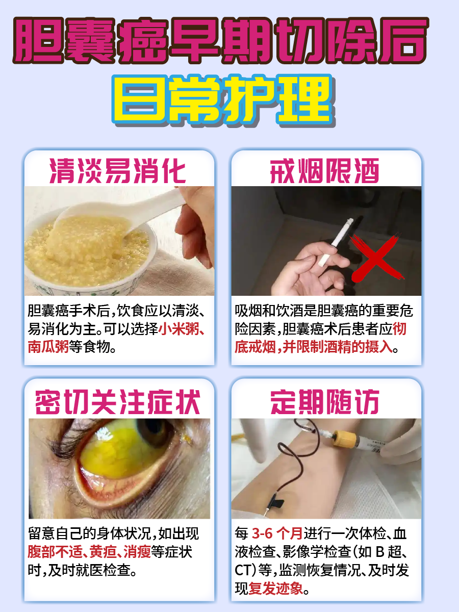 胆囊癌早治早好，早期切除治愈率高！