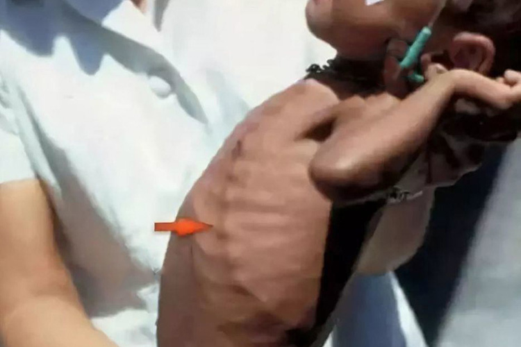 串珠肋图 串珠肋图