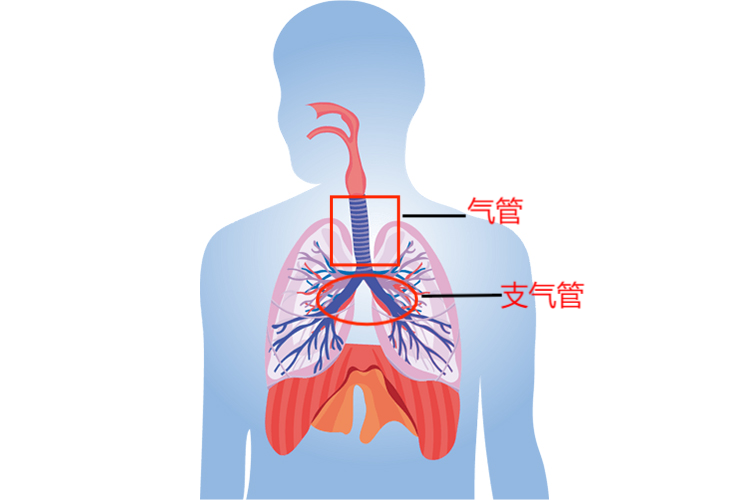 气管及支气管位置图 气管及支气管位置图