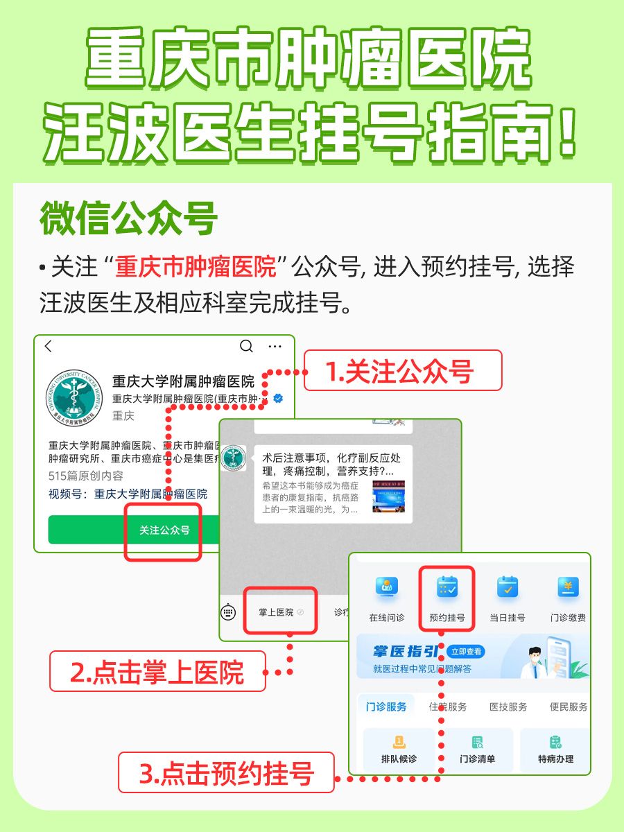 重庆市肿瘤医院汪波医生怎么样？怎么挂号？
