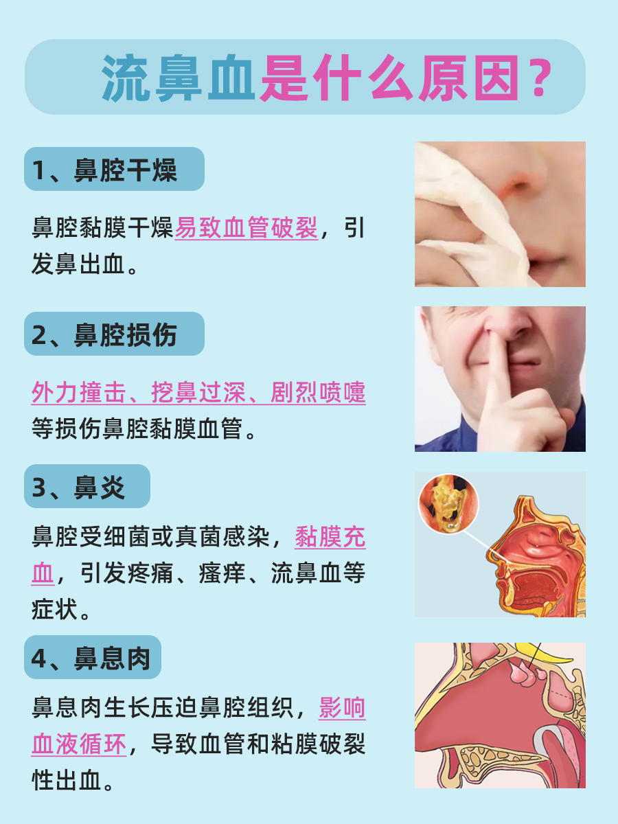 流鼻血是什么原因？看一看便知道