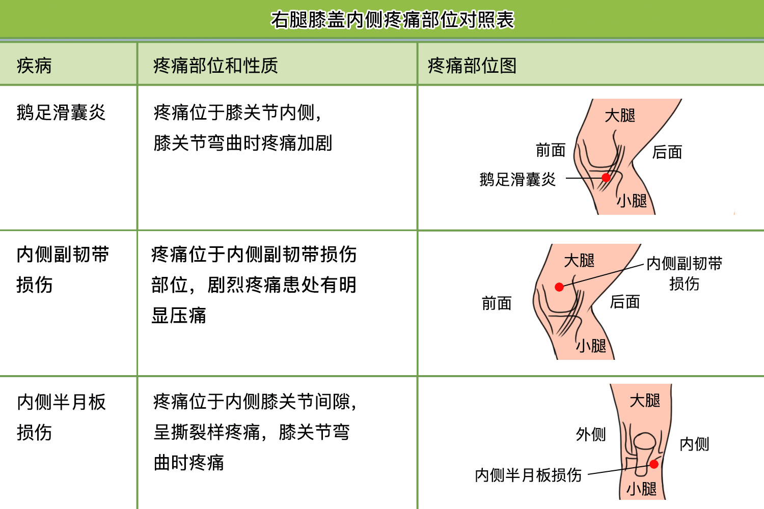 右腿膝盖内侧疼痛部位对照表