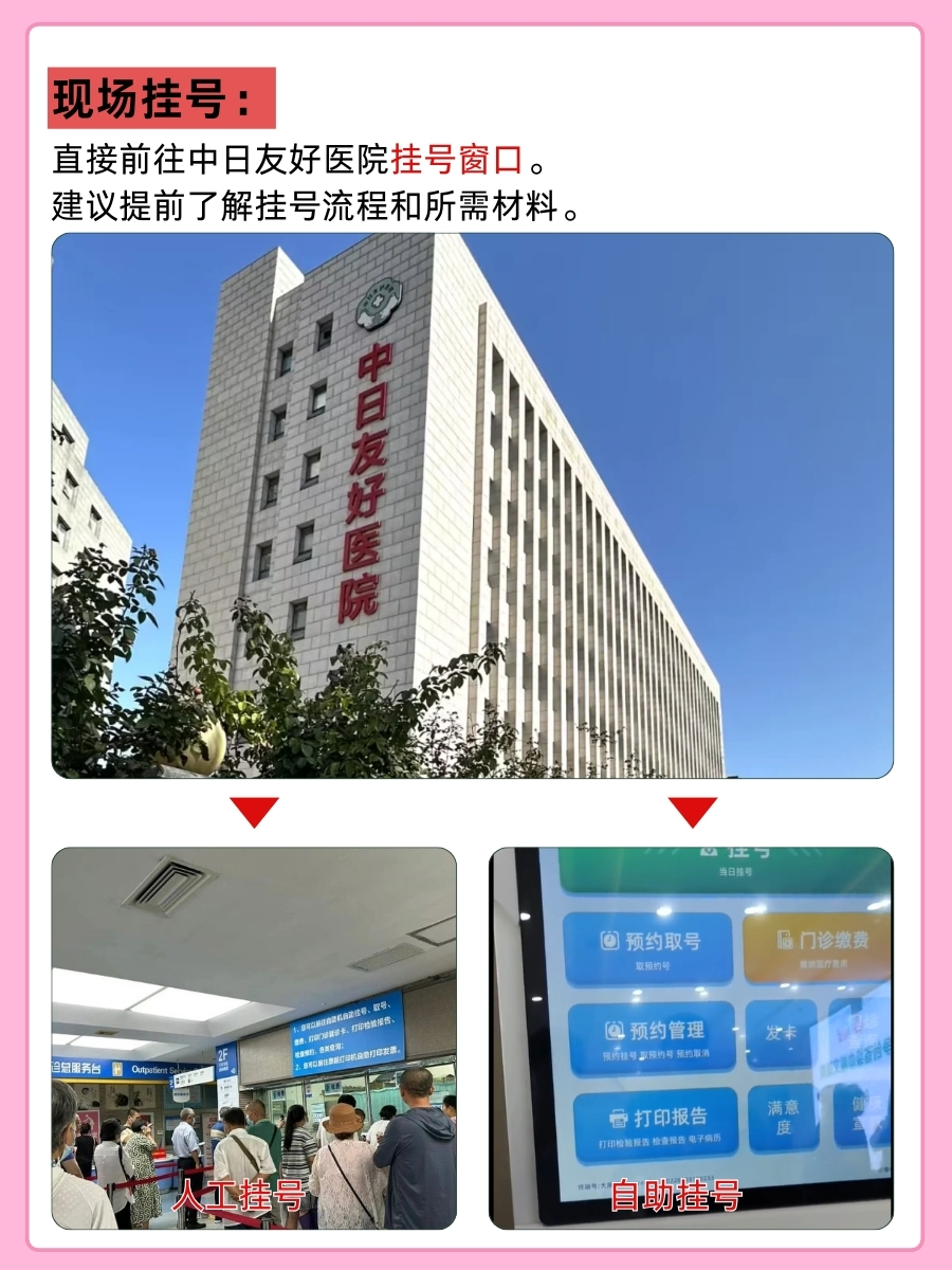 中日友好医院李石良医生怎么样？怎么挂号？