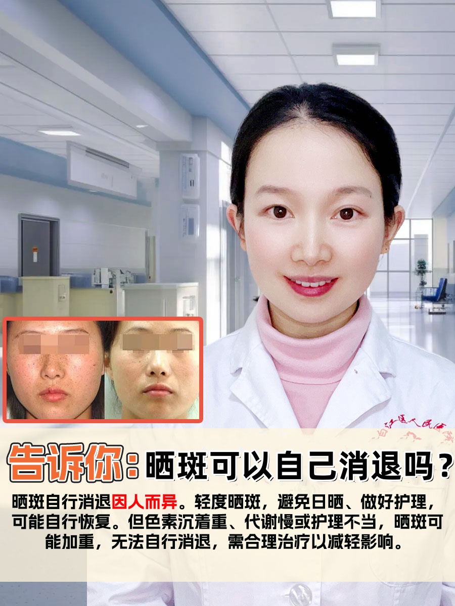 告诉你：晒斑可以自己消退吗？