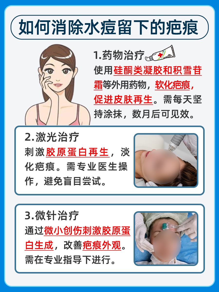 医生告诉你：如何消除水痘留下的疤痕