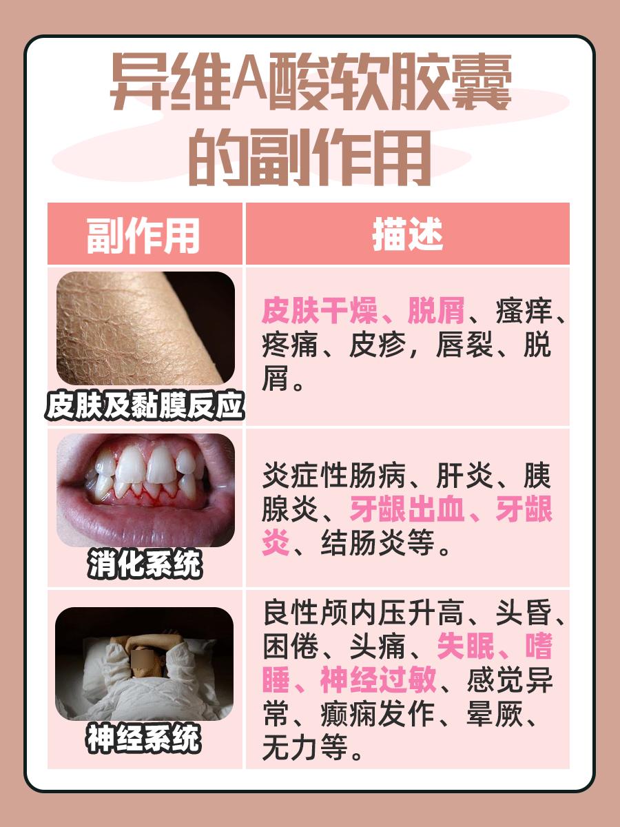 异维A酸软胶囊的功效与副作用,你知道吗