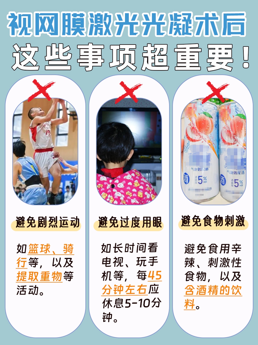 视网膜激光光凝术后恢复指南:休息日数详解