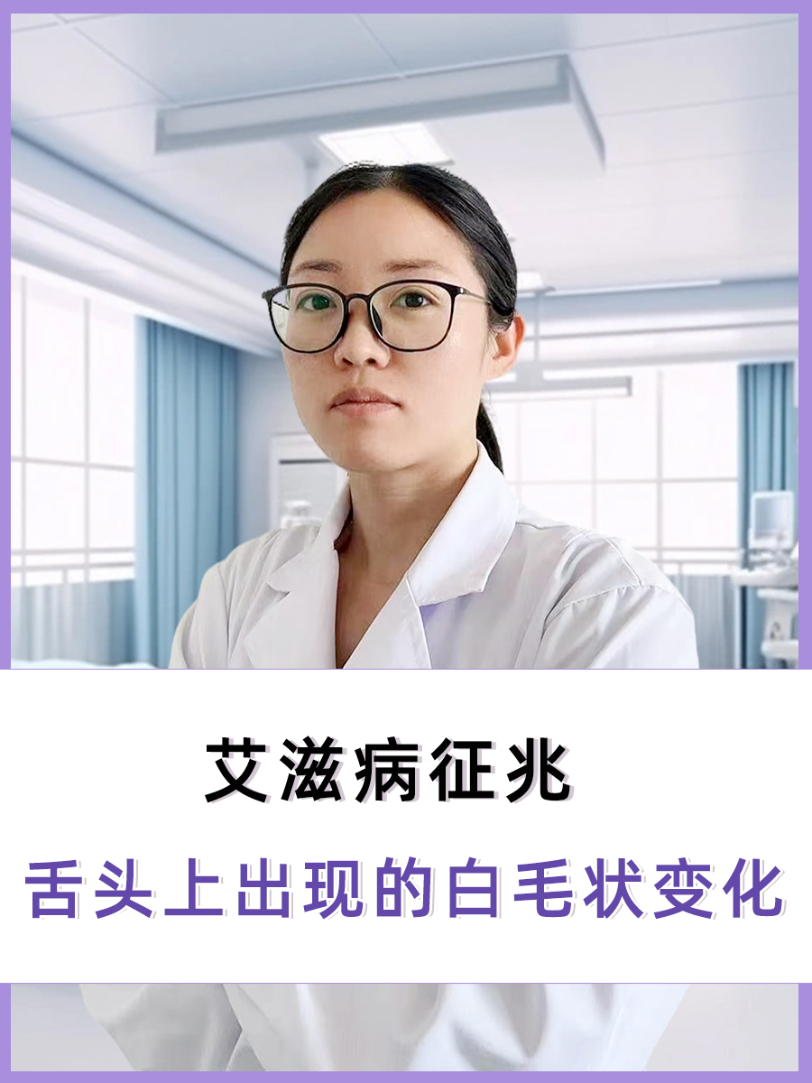 艾滋病征兆：舌头上出现的白毛状变化