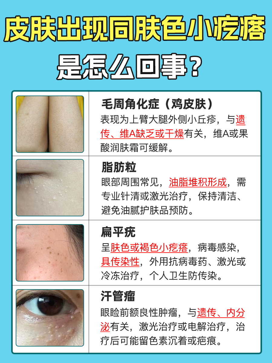 注意!皮肤出现同肤色小疙瘩,这些原因要清楚