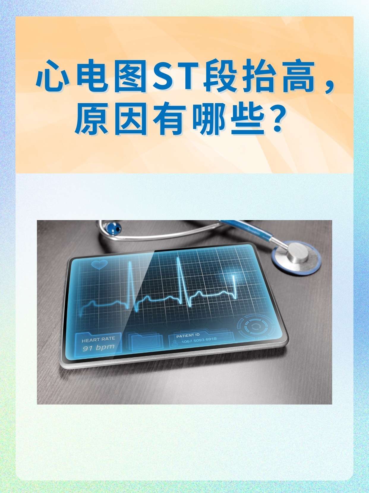 心电图ST段抬高，原因有哪些？