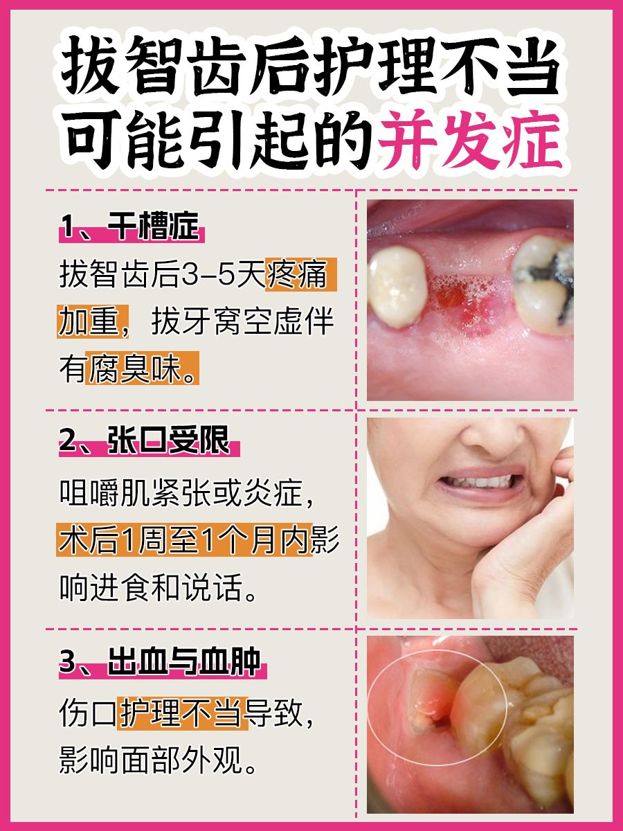 拔完智齿，多久不出血？快来get止血宝典！