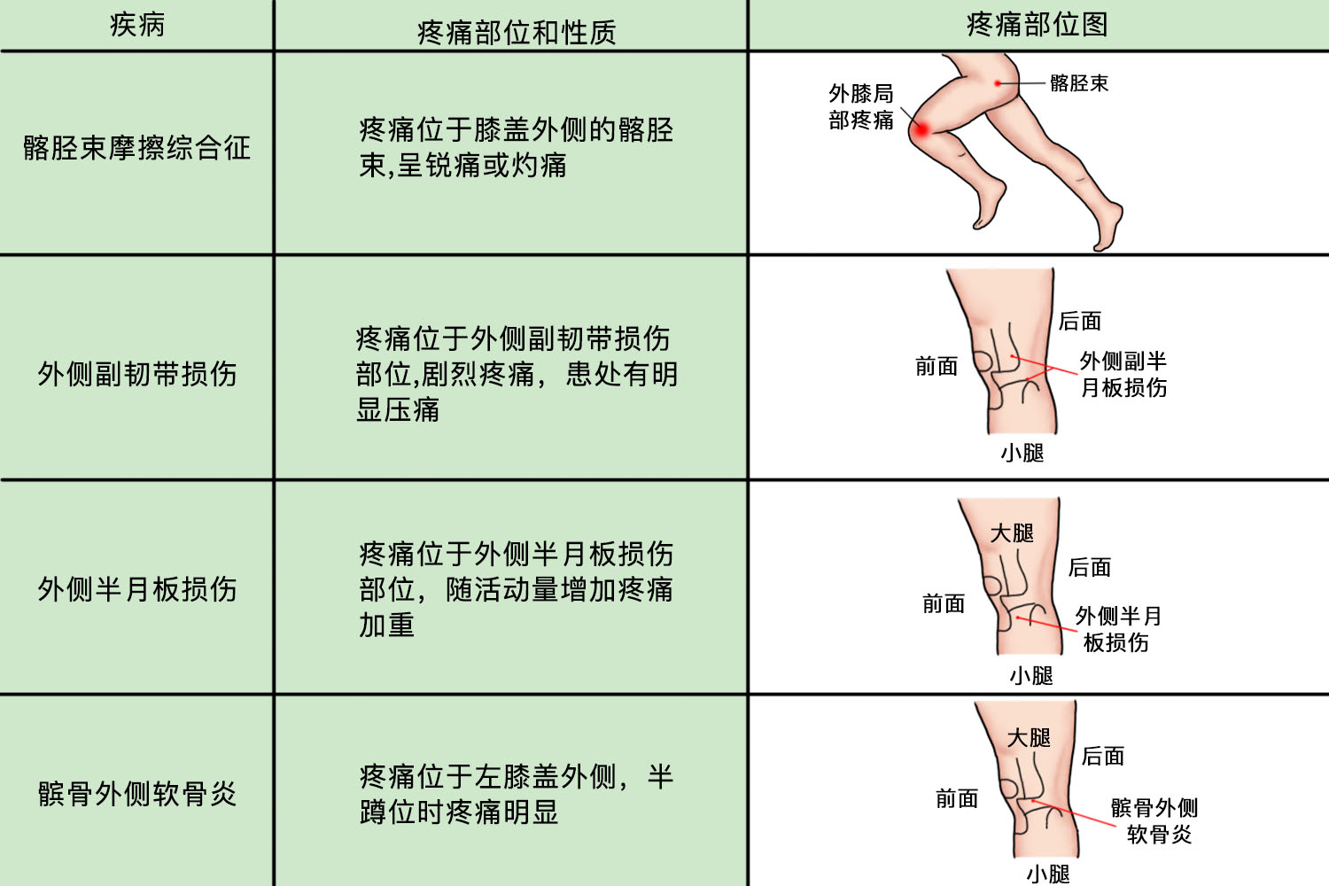 左膝盖外侧疼痛部位对照表