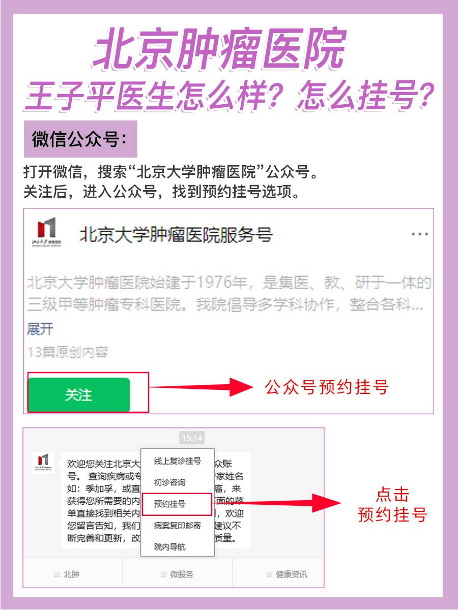 北京肿瘤医院王子平医生怎么样？怎么挂号？