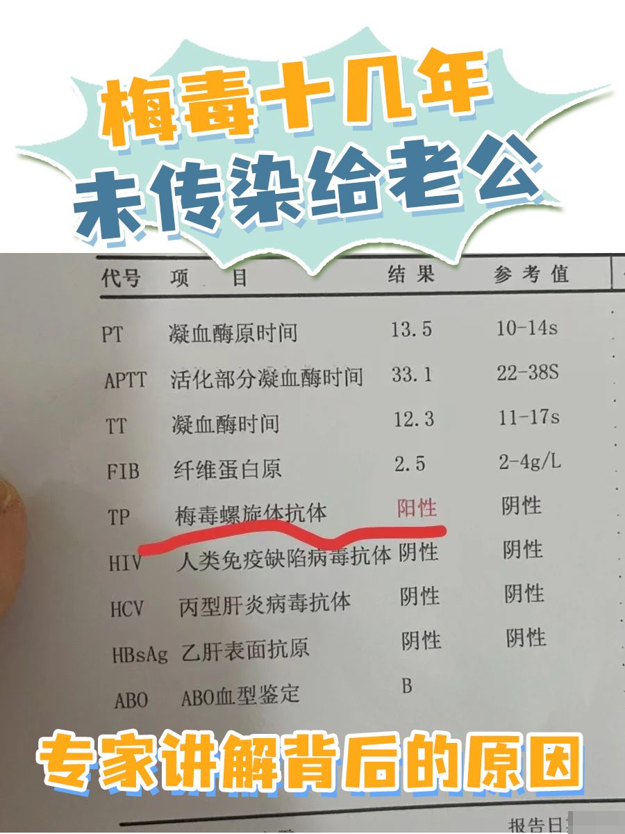 梅毒十几年未传染给老公：专家讲解背后的原因