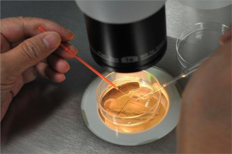 寻找卵冠丘复合体图