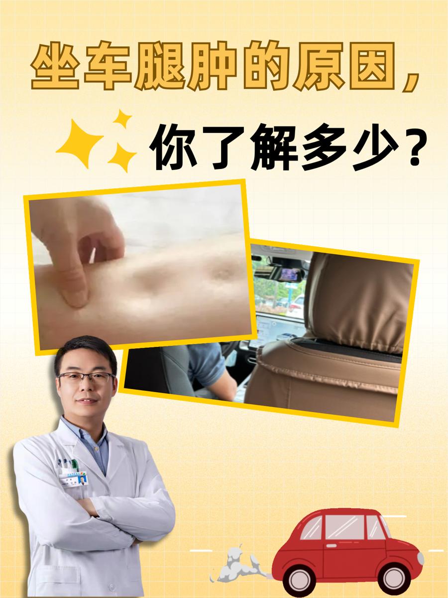坐车腿肿的原因，你了解多少？