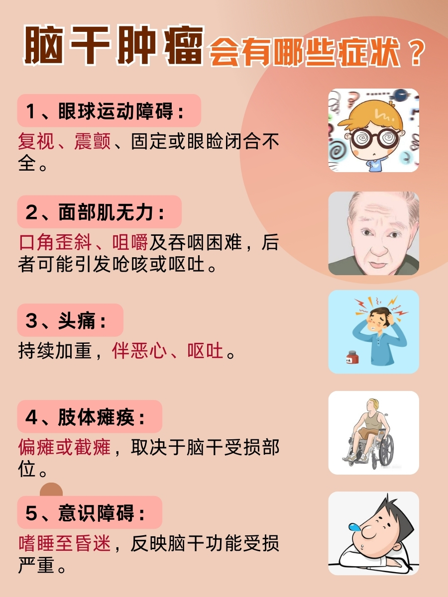 脑干肿瘤有什么症状?一文了解!