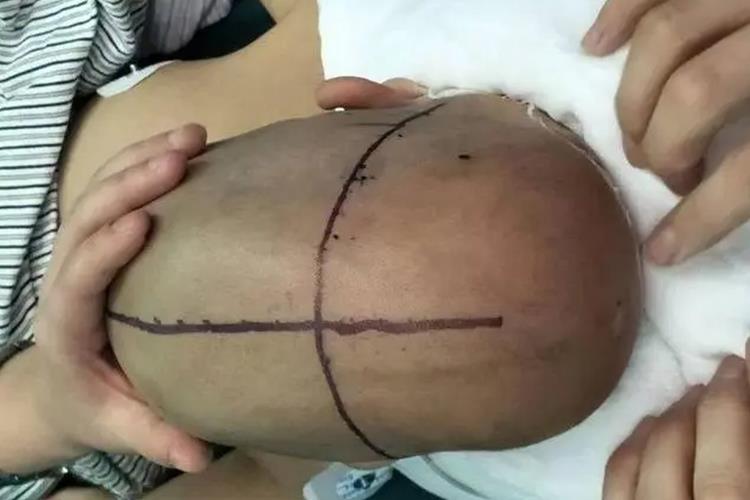 小儿舟状头俯视图