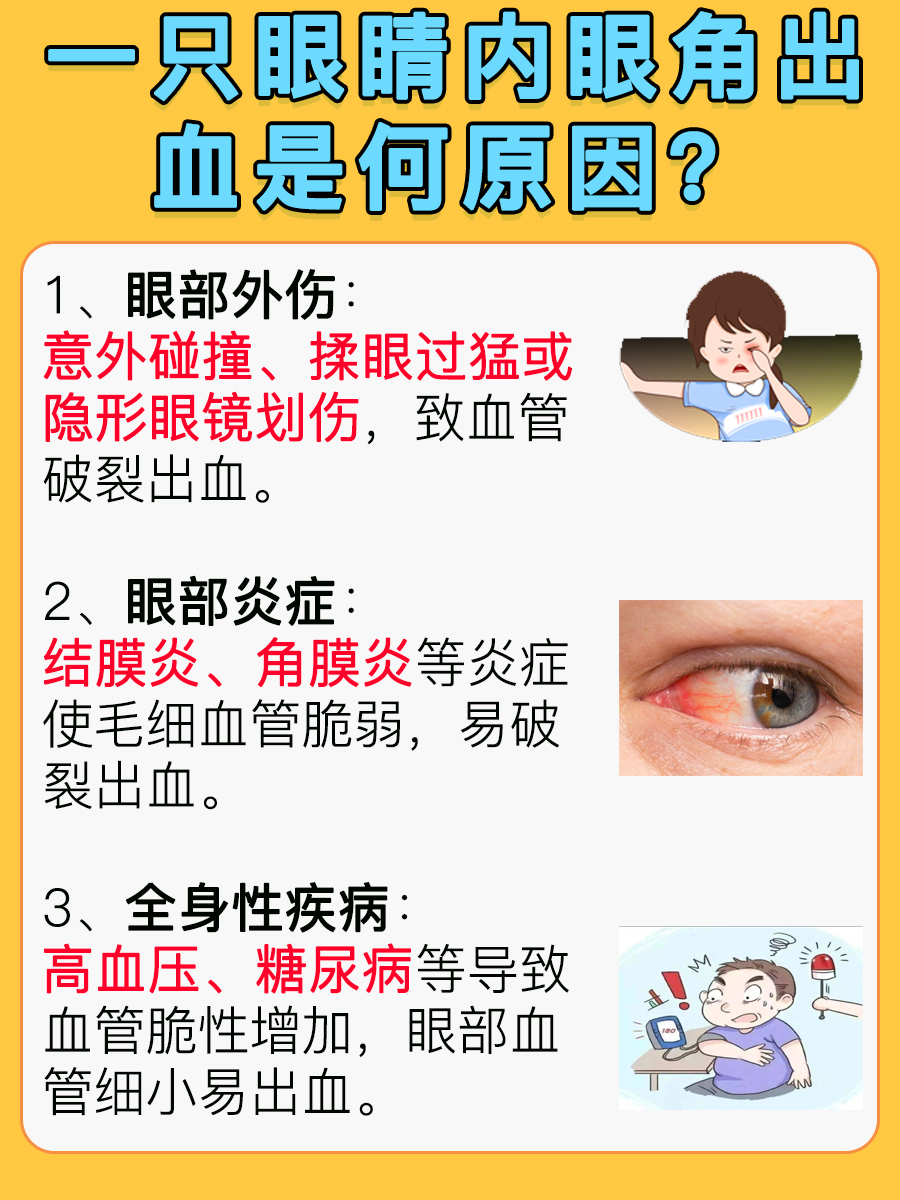 眼睛健康警讯：内眼角出血探究