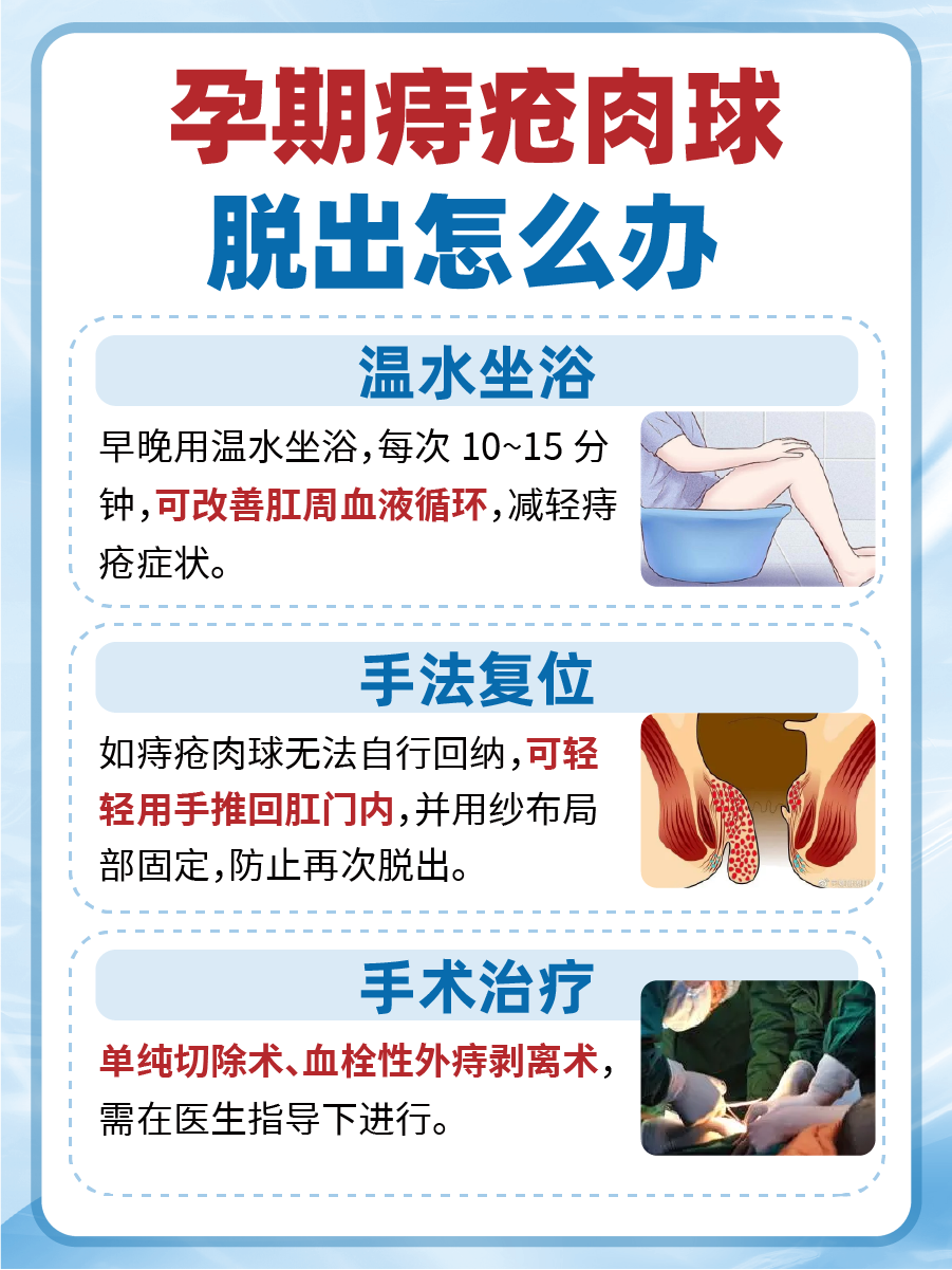 孕期痔疮脱出?这些方法来应对