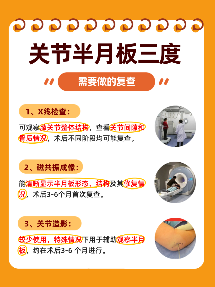 医生解答:膝关节半月板三度撕裂保守治疗可以吗