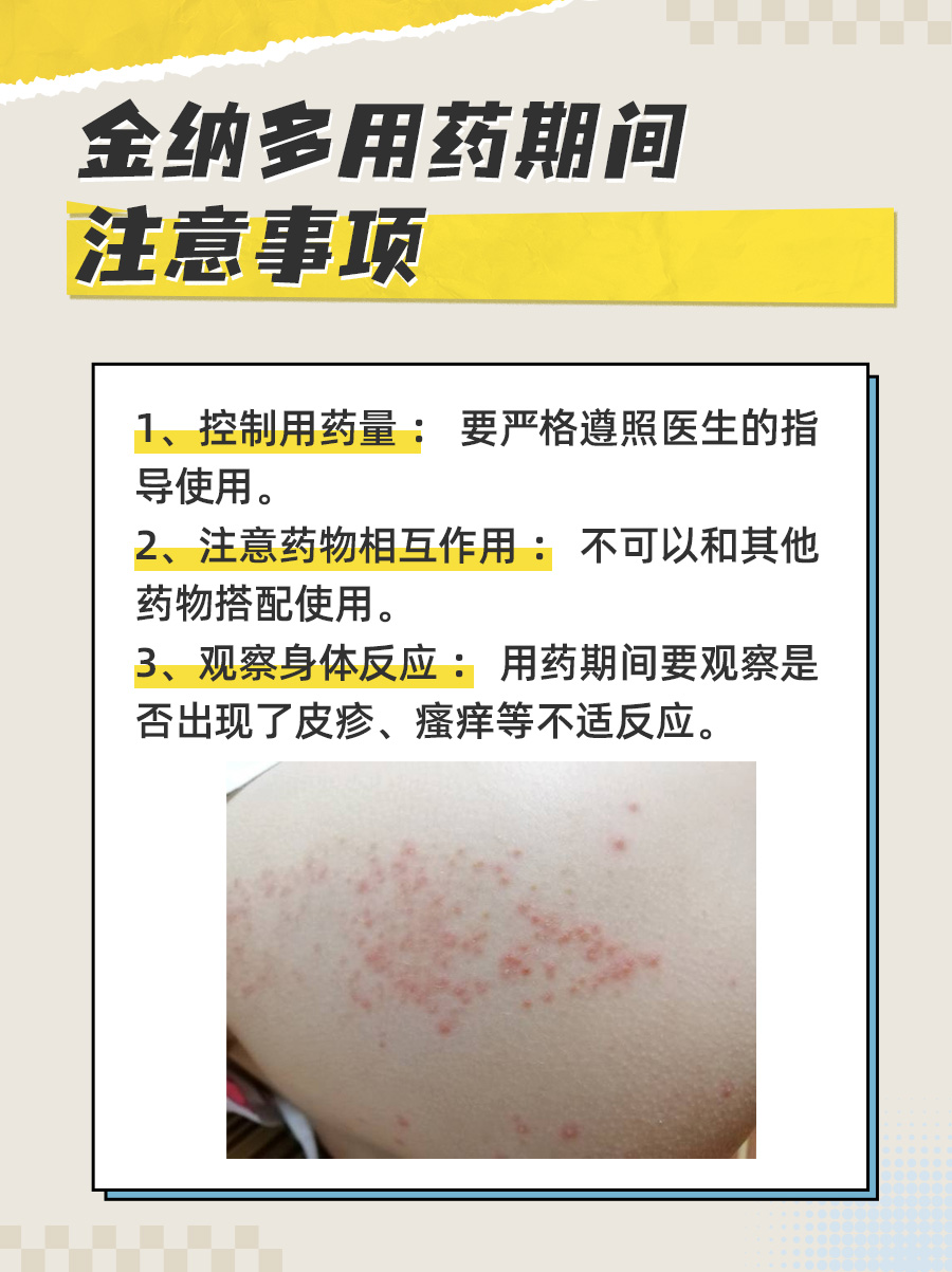 金纳多治疗耳鸣：多久见效的个性化探讨