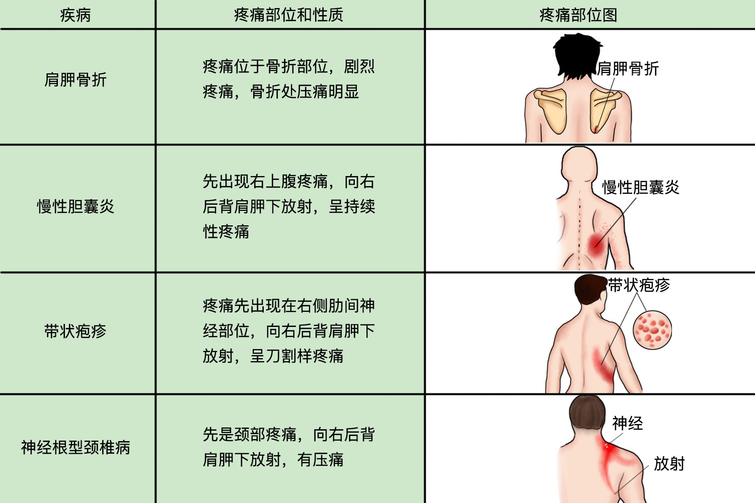 右后背肩胛下疼痛部位对照表
