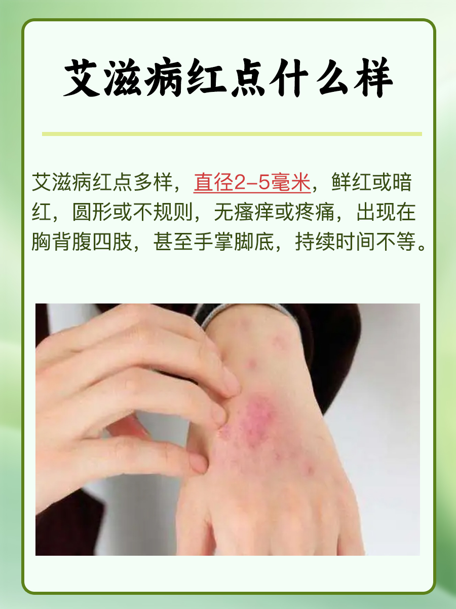 艾滋病红点特征：识别与了解