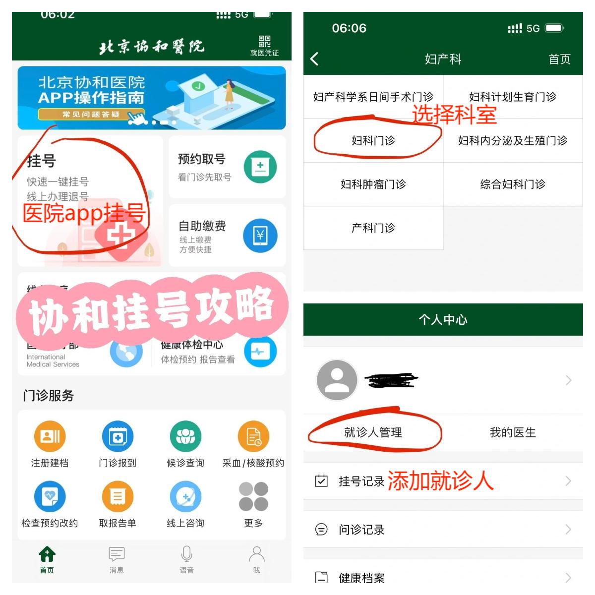 北京协和医院周慧梅医生怎么样？怎么挂号？