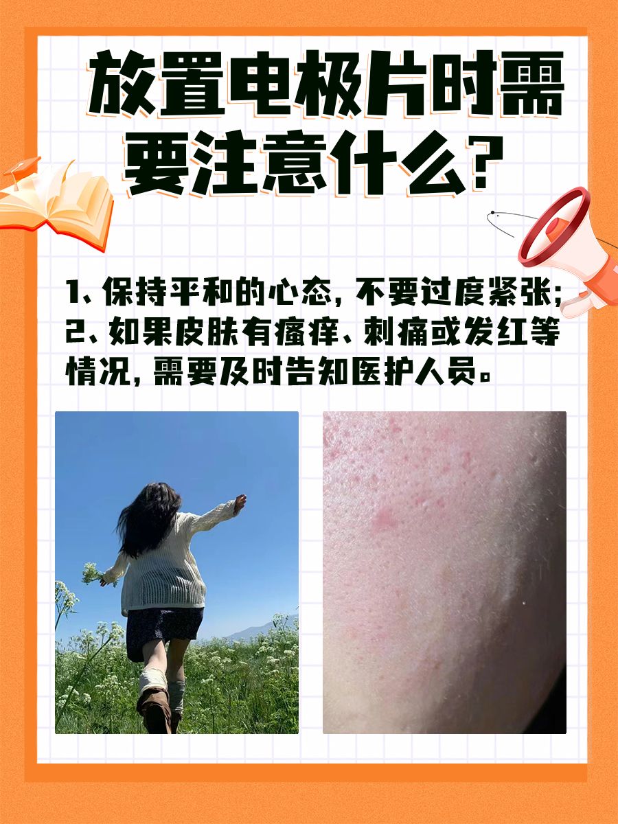 监护仪上的PLETH，你知道是什么吗？