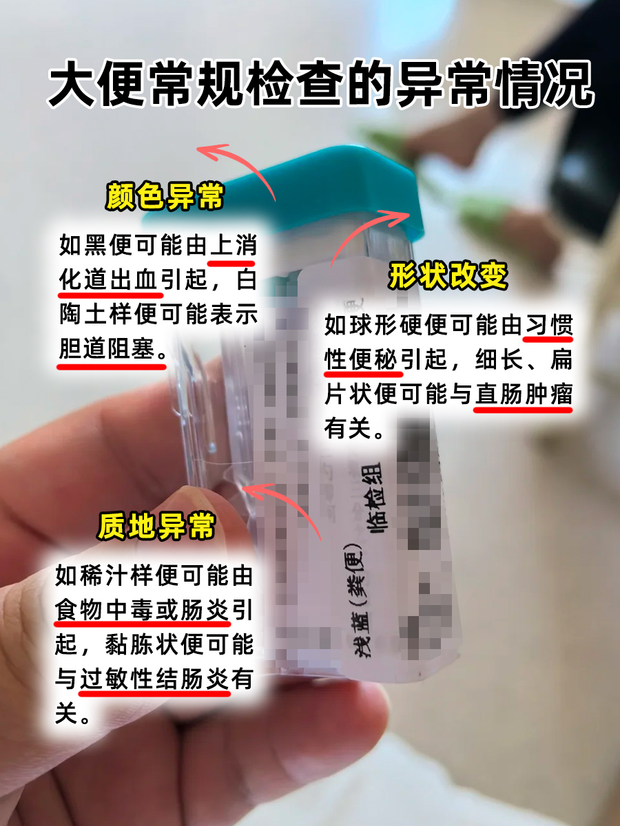 你知道吗？大便常规检查的价格竟然这么亲民！