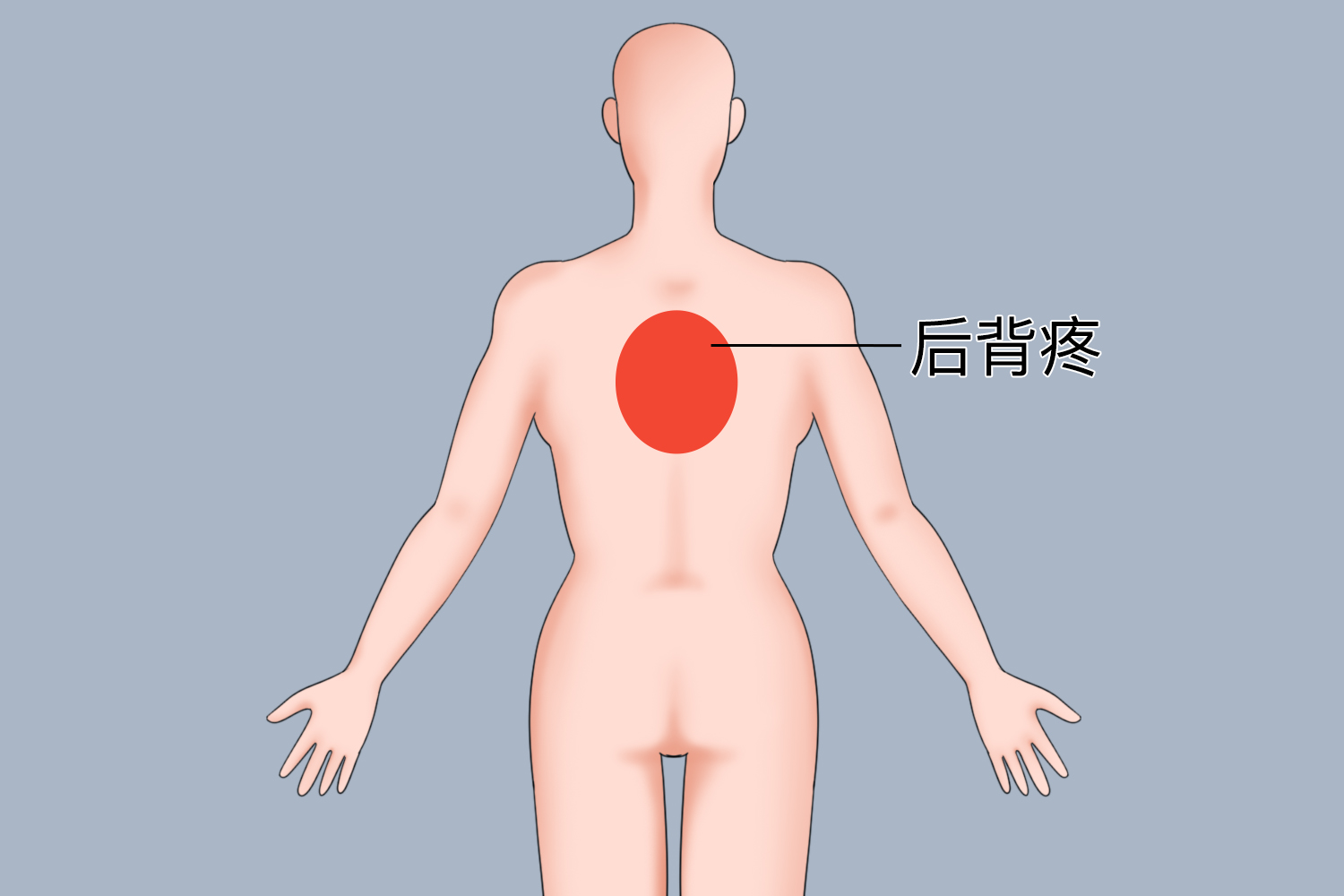 心梗后背部上方疼痛位置图