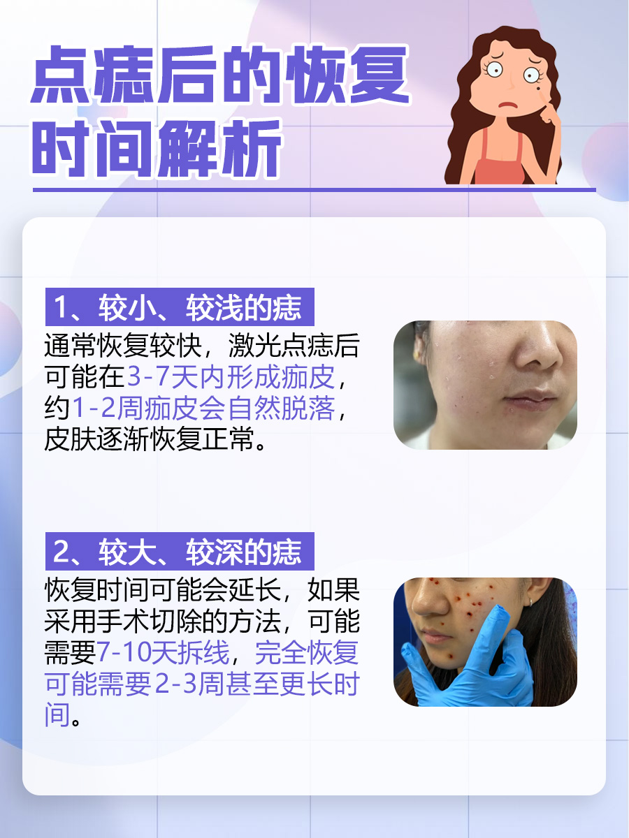 正规医院点痣多少钱？医生专业解答