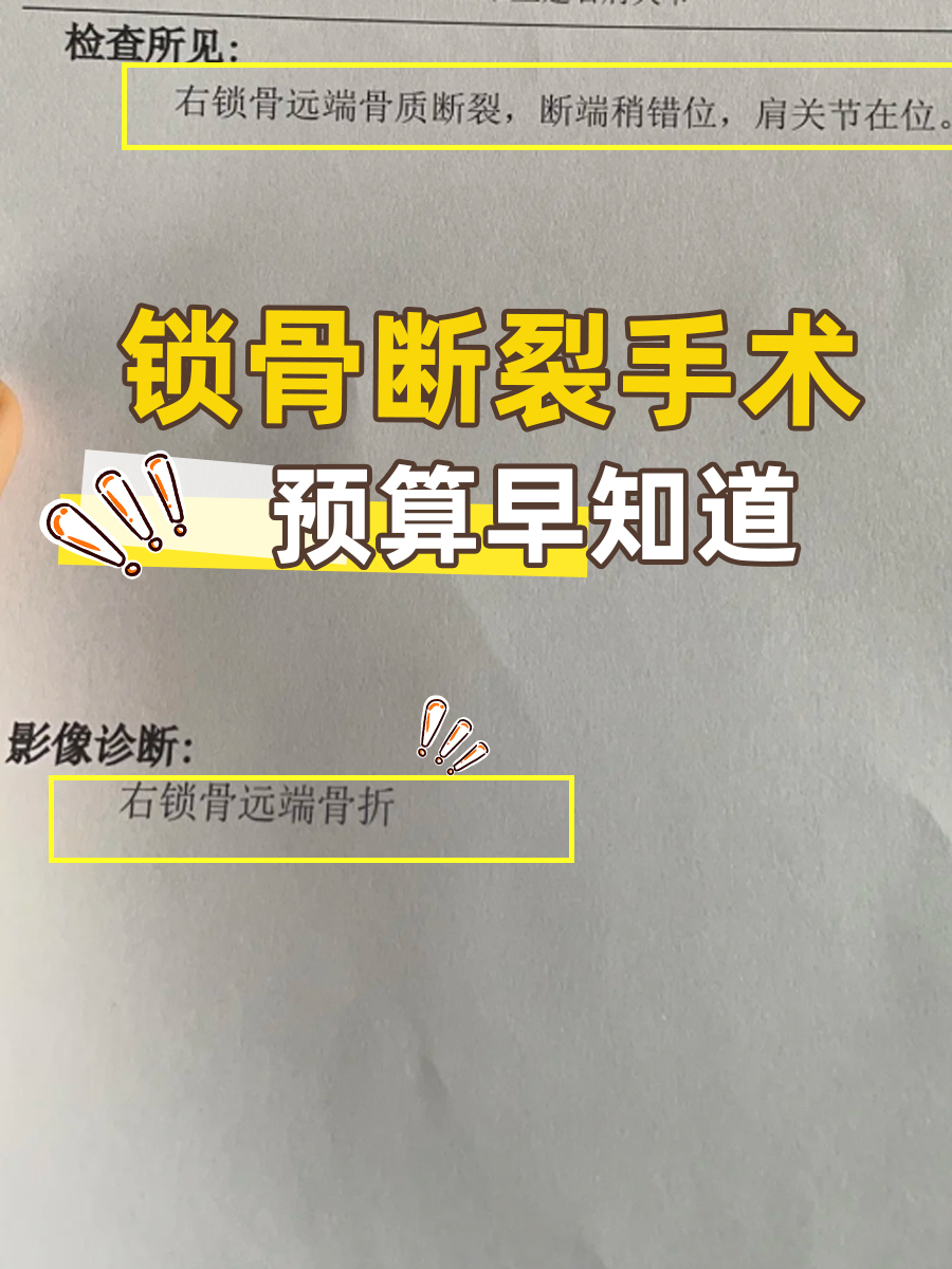 锁骨断裂手术,预算早知道