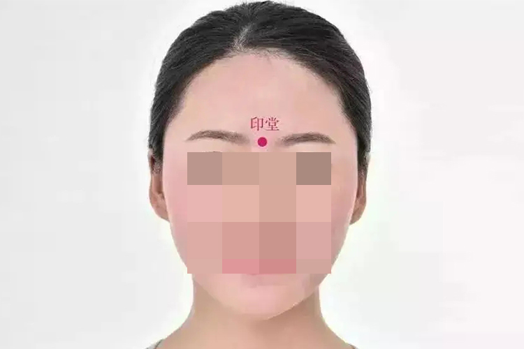 印堂穴位置图