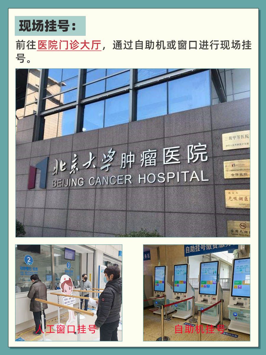 北京肿瘤医院钱红纲医生怎么样?怎么挂号?
