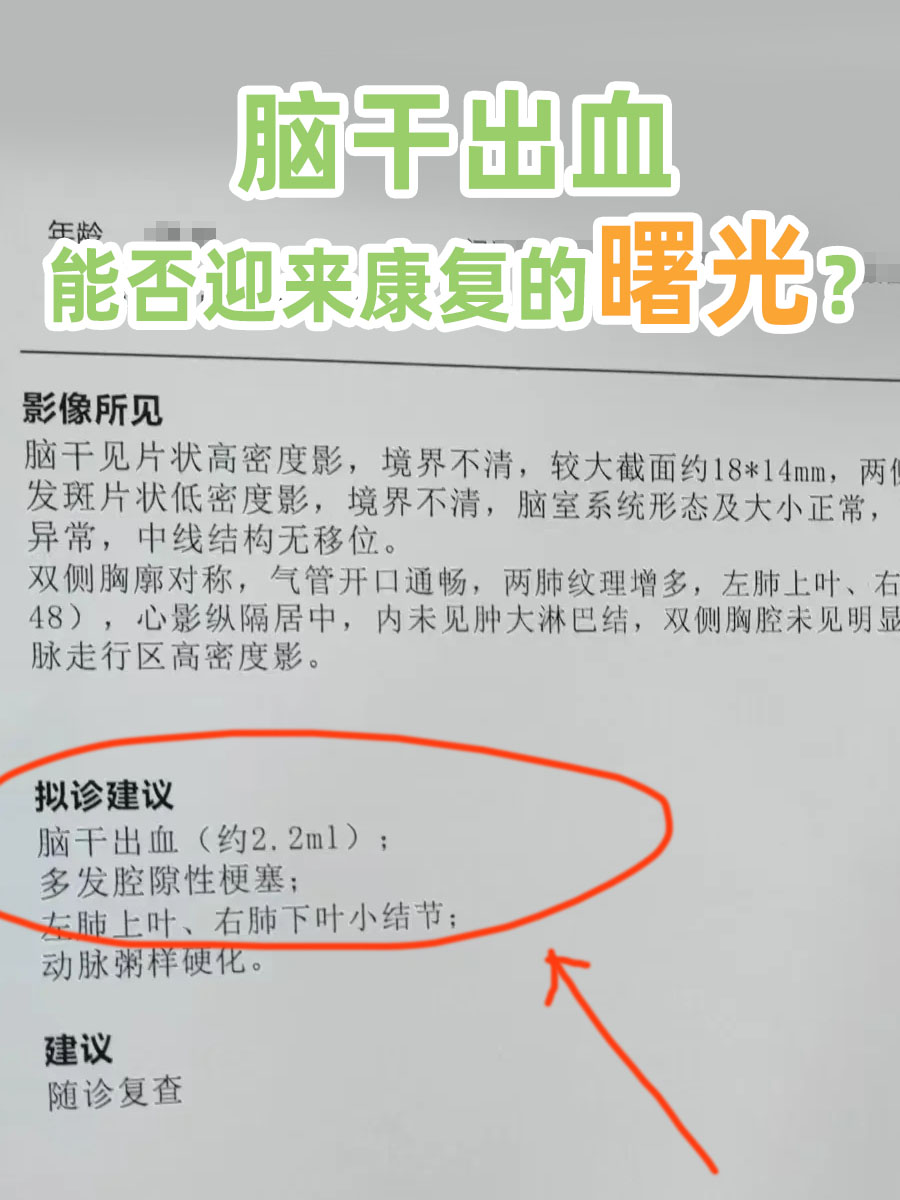 脑干出血，能否迎来康复的曙光？