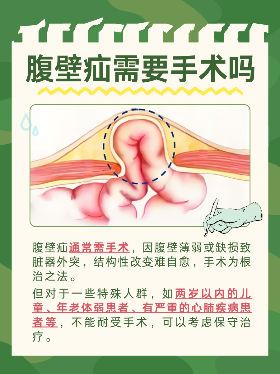 腹壁疝需要手术吗，一文解析