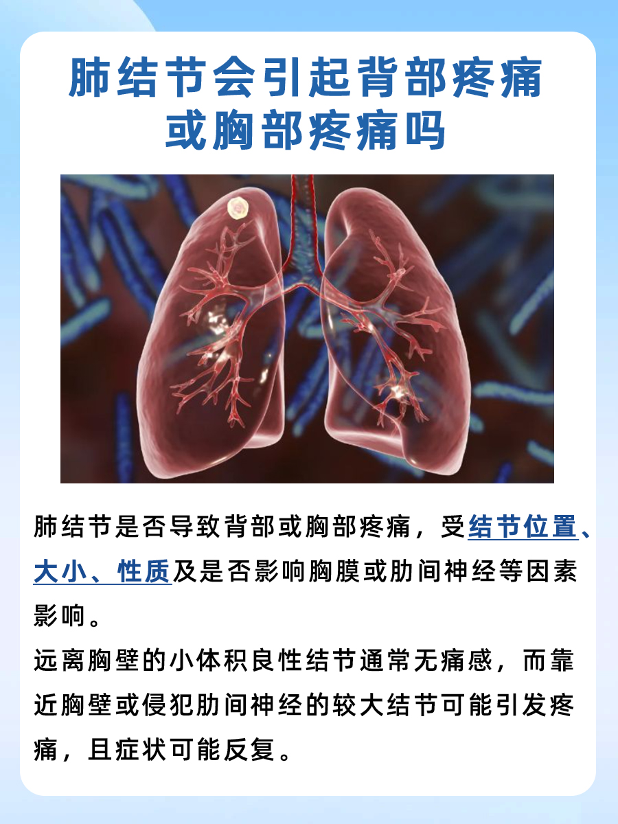 肺结节会引起背部疼痛或胸部疼痛吗,答案揭晓