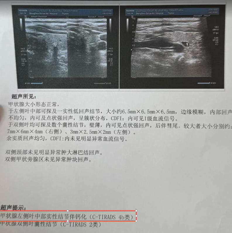 甲状腺结节4a类要报告单.jpg