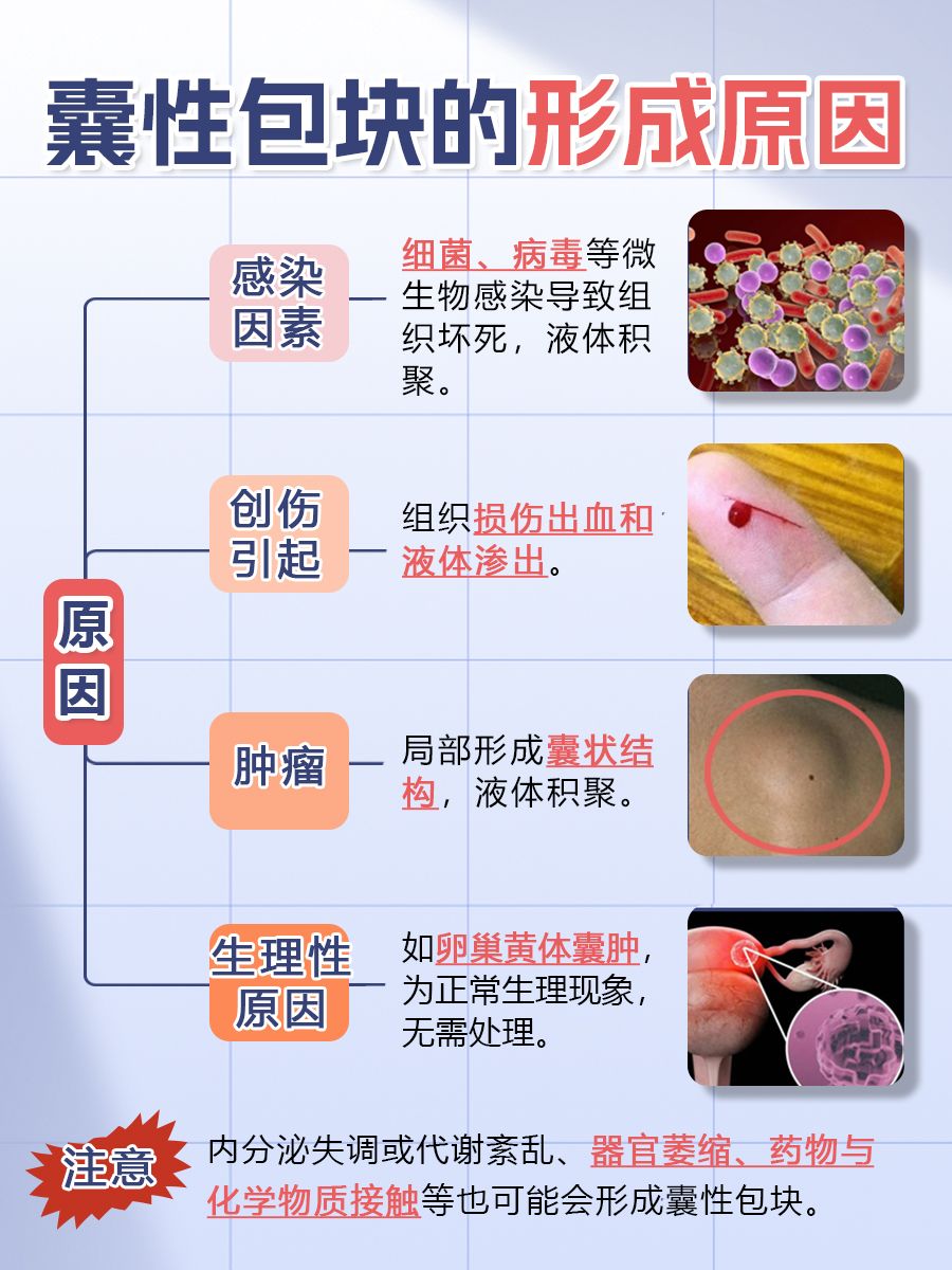 囊性包块知多少？一文带你了解它的严重性