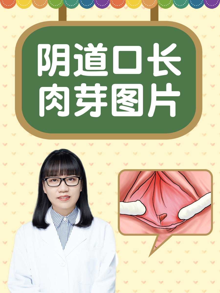 阴道口长肉芽图片