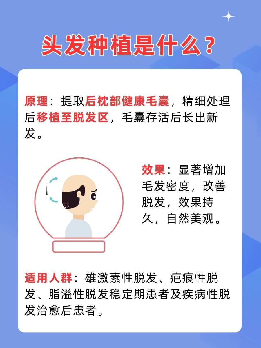 揭秘，头发种植到底是怎么一回事？