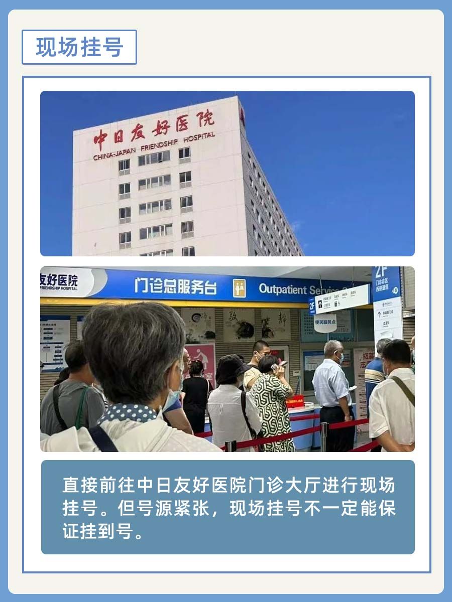 中日友好医院李石良医生怎么样？怎么挂号？