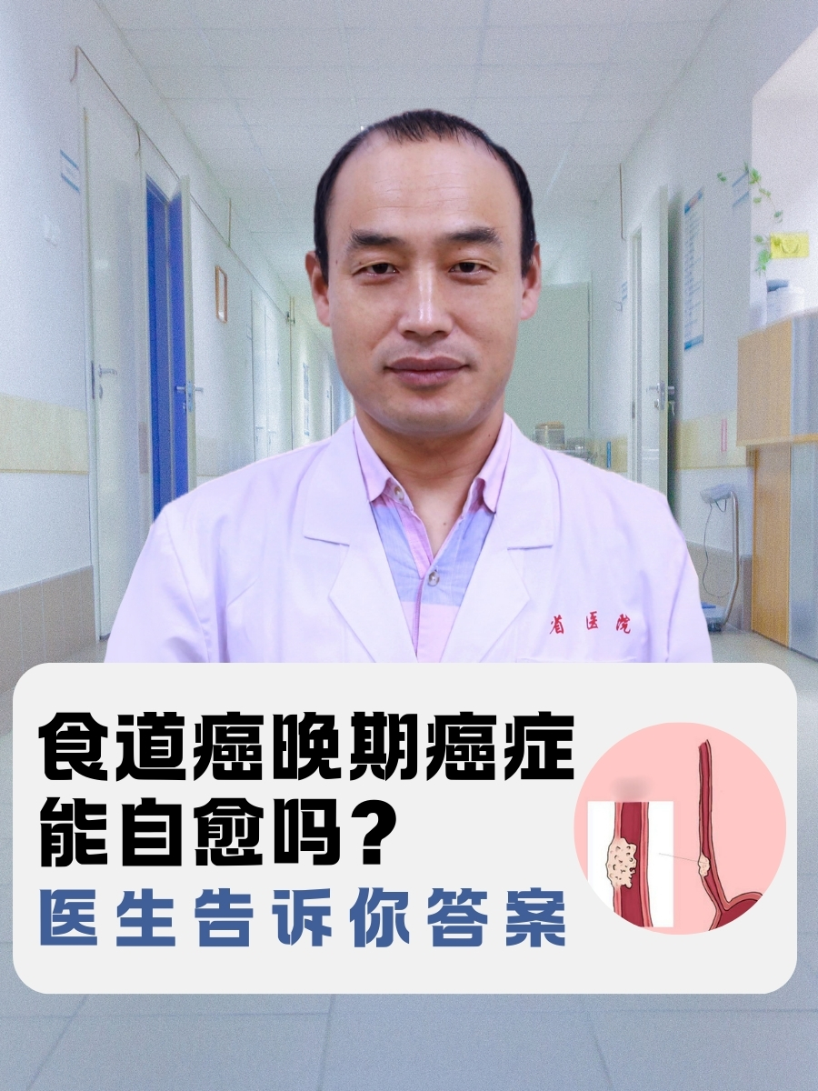 食道癌晚期癌症能自愈吗？医生告诉你答案