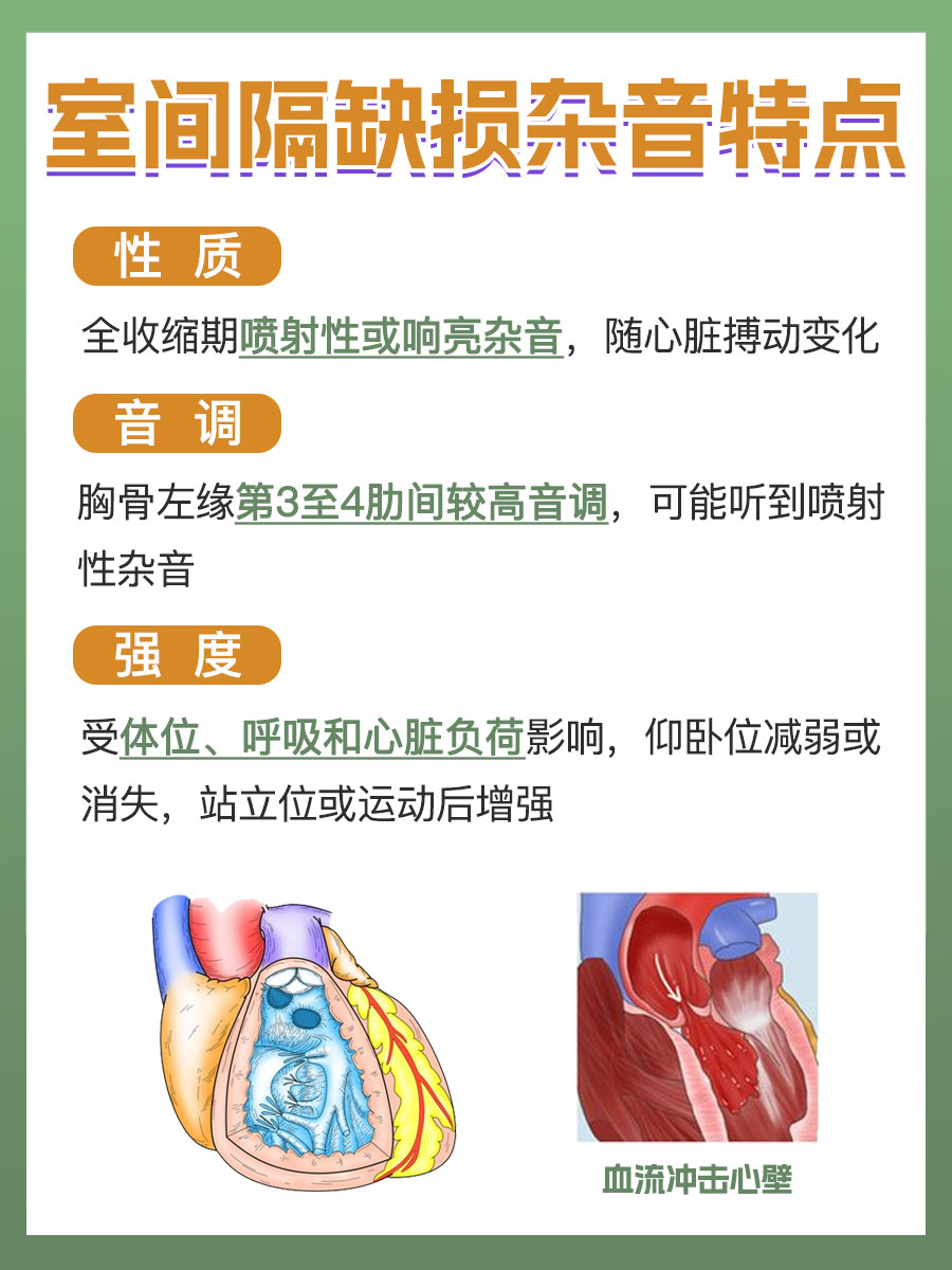 室间隔缺损的杂音特点：识别先心病的重要线索