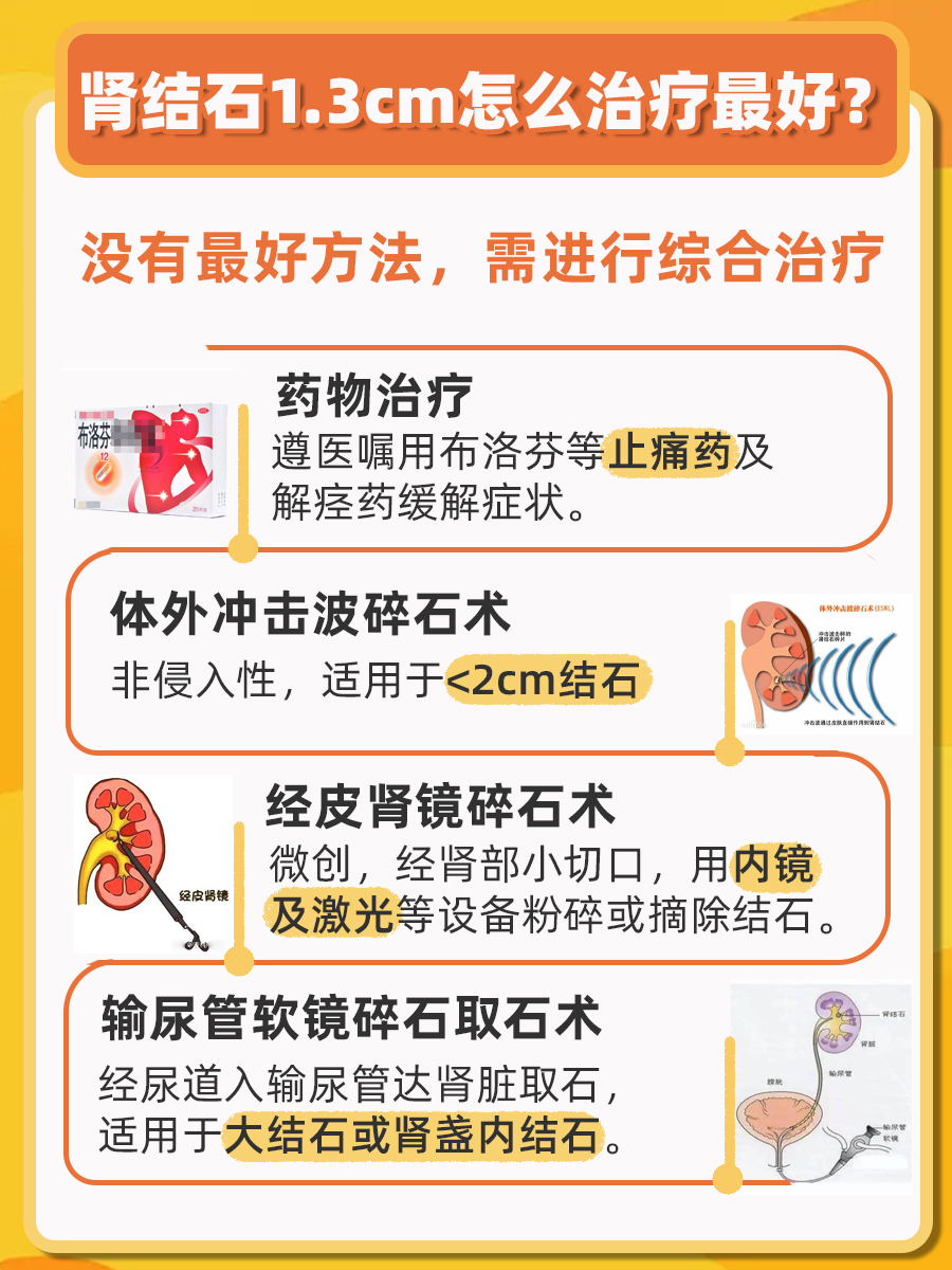 告别1.3cm肾结石，怎么治疗最好？
