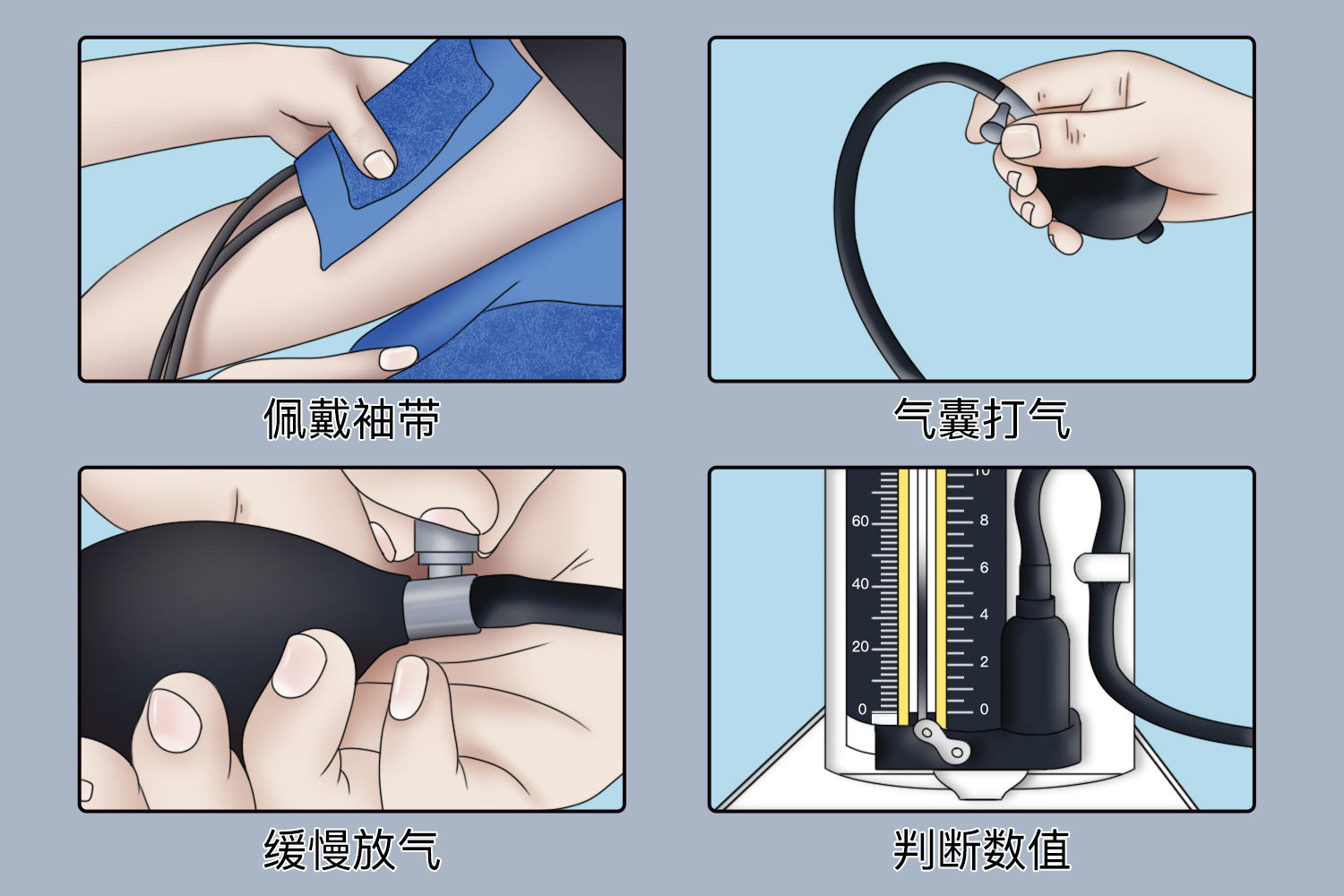汞柱式血压计图